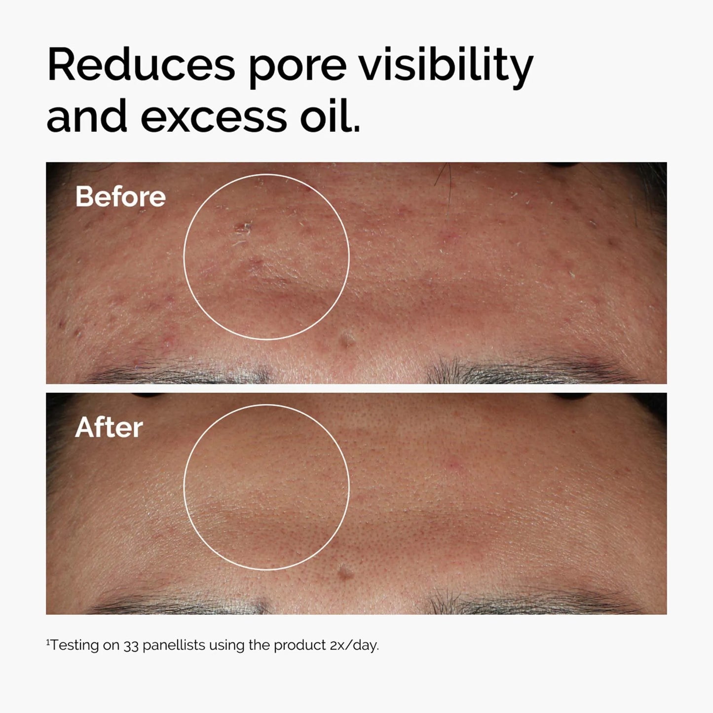 The Ordinary Alpha Arbutin 2% + HA Serum 30 ML